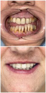 stomatologia estetyczna