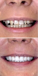 stomatologia estetyczna