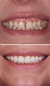 metamorfoza uśmiechu