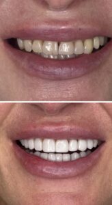 stomatologia estetyczna